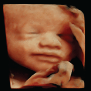 Gallery 9 Elective HD Ultrasound