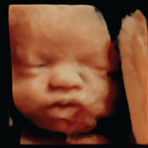 Gallery 7 Elective HD Ultrasound