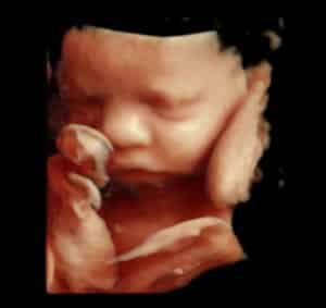 Gallery 12 Elective HD Ultrasound