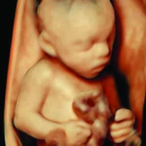 Gallery 1 Elective HD Ultrasound