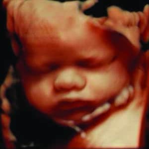 Gallery 2 Elective HD Ultrasound