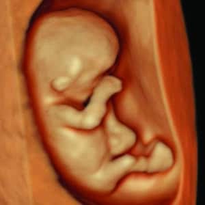 Gallery 4 Elective HD Ultrasound