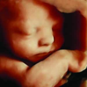 Gallery 5 Elective HD Ultrasound