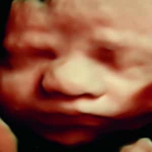 Gallery 6 Elective HD Ultrasound